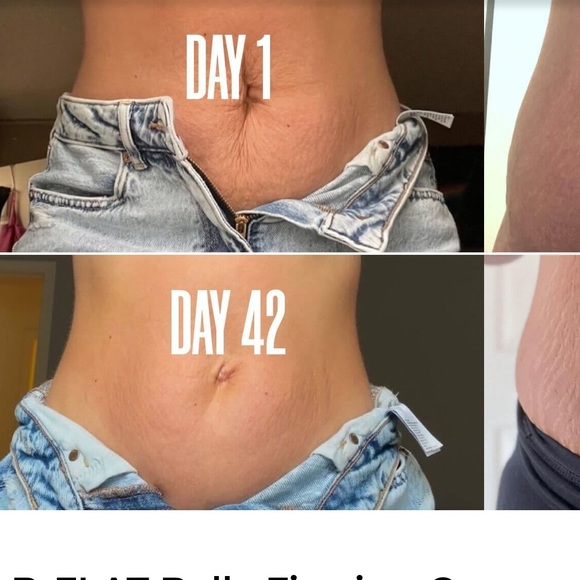 COPY - MAELYS B-FLAT BELLY FIRMING CREAM 100ML - Picture 3 of 11